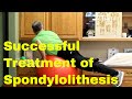 Successful Spondylolisthesis Treatment Without Surgery-Live Active & Pain-Free