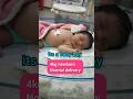 4kg Newborn Baby Normal Delivery Shorts