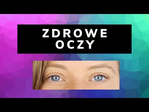 Wideo: Jak obniżyć poziom hormonów stymulujących tarczycę: 11 kroków