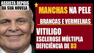 Manchas vasos brancas sanguíneos quebrados com