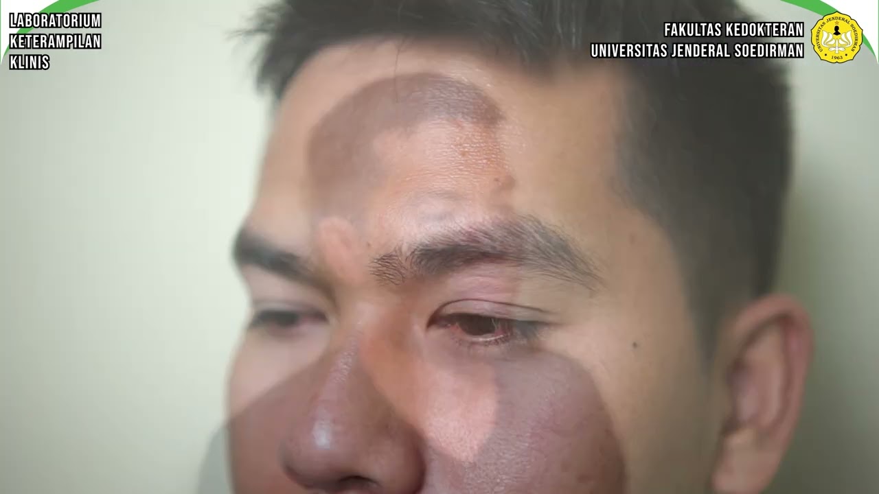 PEMERIKSAAN SEGMEN ANTERIOR MATA