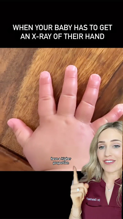 Why babies have different hands