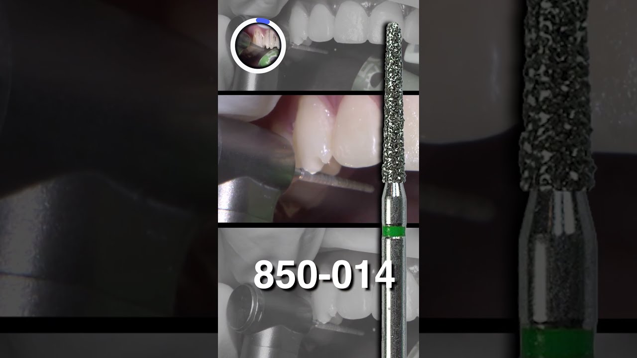 Preparing ANTERIOR Teeth For Hollywoodsmile Dentalshorts