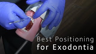Best Positioning for Minimally Invasive Exodontia