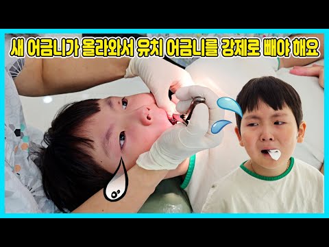 잇몸 밑에서 새 <strong>어금니가</strong> 올라와서 당장 유치 어금니를 빼야 한데요ㅠㅠ 얼떨결에 어금니를 뺐어요 [사랑아놀자 LOVE&amp;amp;TORY]