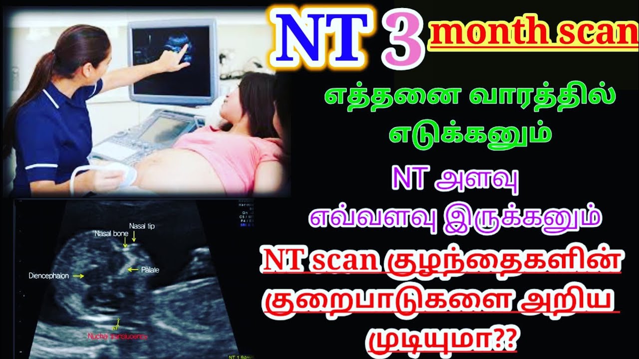 NT scan during pregnancy in tamil// 3 months pregnancy scan in tamil