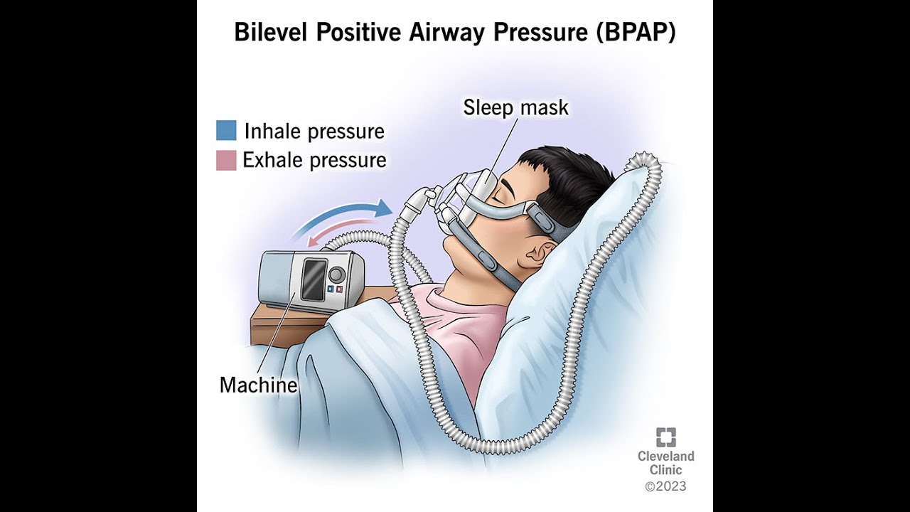 BiPAP - Essential Breathing Management for DMD/MD Patients?- Must know ...