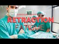 Retraction  fatigue