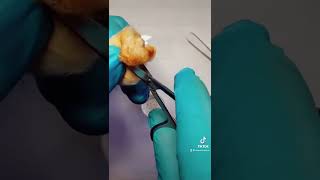 Cigarette filter before and after use! Net Worth
