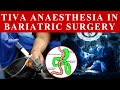 What is TIVA anesthesia? Switch on/off??