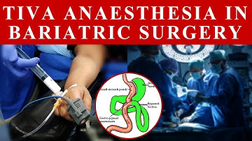 What is TIVA anesthesia? Switch on/off??
