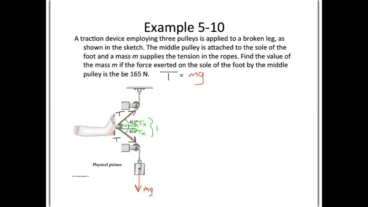 HPhy1 - Ch 05 notes - Ex 5-10 Traction System