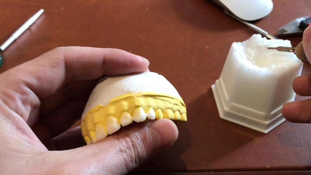 Artikülatörde Wax-Up Çalışması