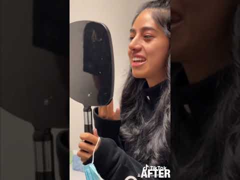 Video thumbnail: "I Can't Believe This Is Real!" - A Patient's Nose Reveal · Dr. Anil Shah