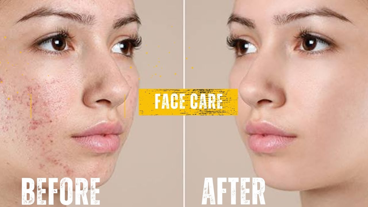 𝕄𝕐 𝔻𝔸𝕀𝕃𝕐 𝔽𝔸ℂ𝔼 ℂ𝔸ℝ𝔼 like 𝓶𝔂 ८Һα𝖓ⁿê𝕝 𝖆𝖓𝖉 𝕤𝕦𝕓𝕤𝕔𝕣𝕚𝕓𝕖 YouTube