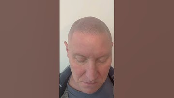 Life changing Hair Tattoo better known as SMP!