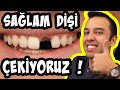 Ortodontik Diş Çekimi | '' Diş Çekmeden Olmaz mı ? " - Dr. Deniz Ertüz