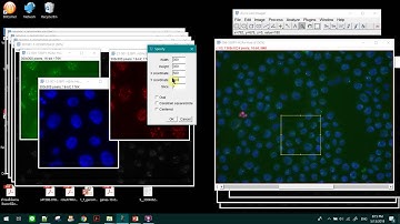 How to crop specific region in image J #imagej  #imageprocessing