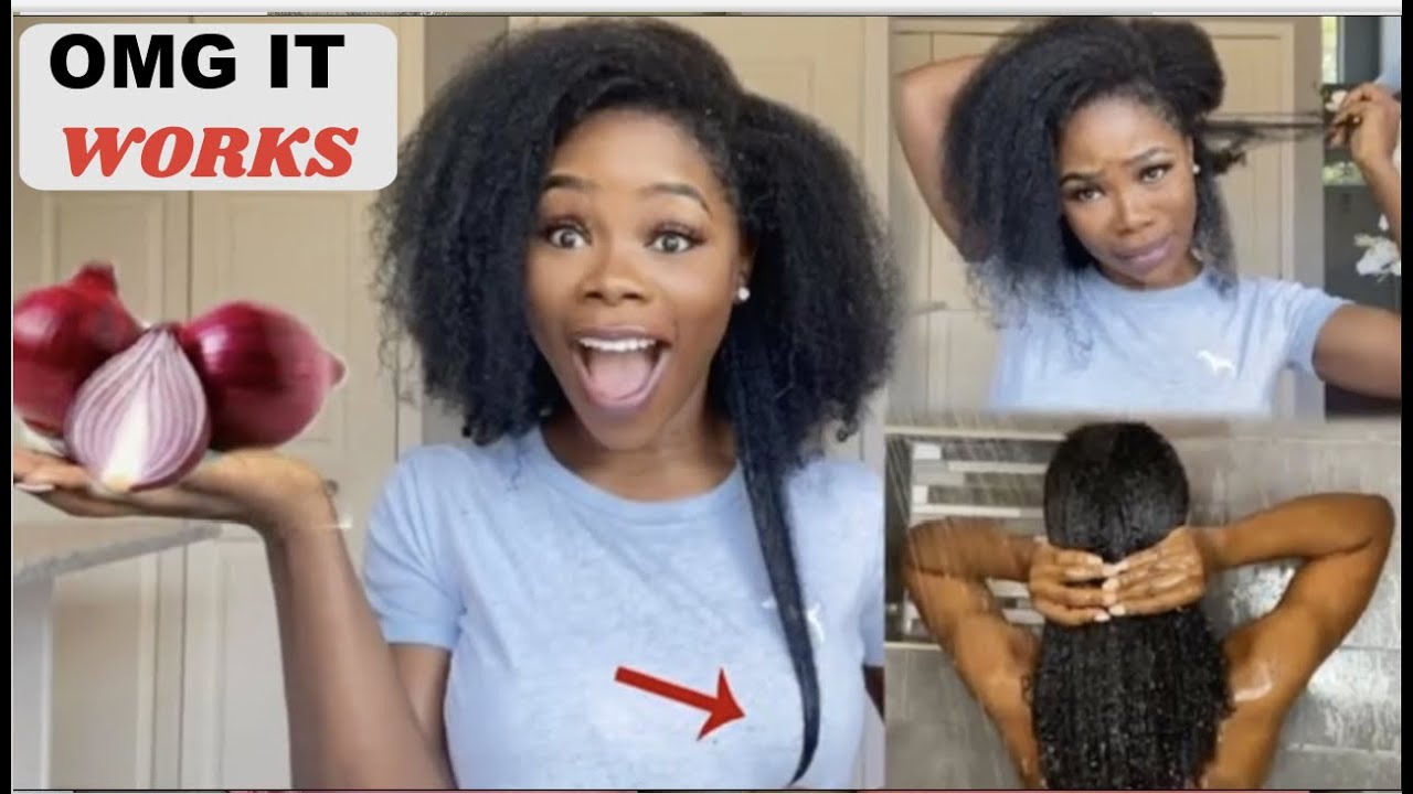 3 ways to use onions for massive Hair growth. How to make onion juice