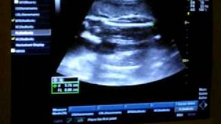 20091211(30W).MOV