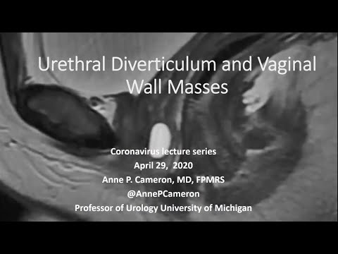 4.29.2020 Urology COViD Didactics - Urethral Diverticulum and Vaginal Wall Masses