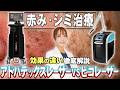 肌の赤み・シミをなくす方法！アドバテックスレーザーとピコレーザーの効果の違いをわかりやすく解説しました！