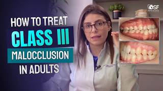 Class III Malocclusion Treatment: What Every Orthodontist Needs to Know