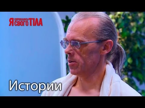 Игорь Крот избавился от паховой грыжи мелодрамы 2019 односерийные