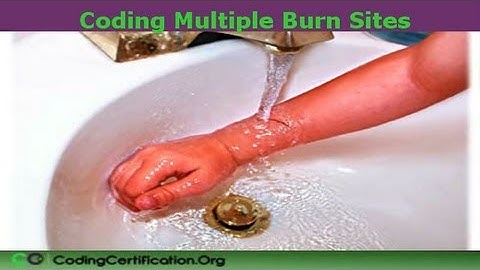 Medical Coding Multiple Burn Sites