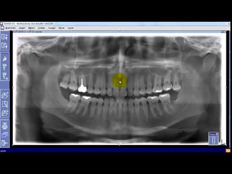 Video: ¿Qué formato de archivo son los rayos X?