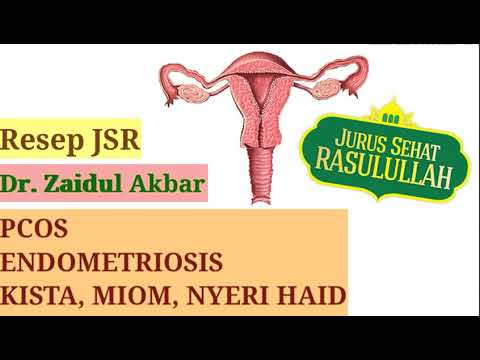 Endometriosis Zaidul Akbar