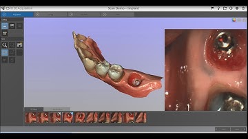 CS 3600 Soft Tissue Capturing