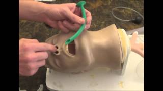Inserting a NPA (nose hose)