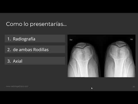 Vídeo: Quan Es Programa Una Radiografia