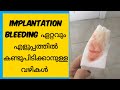 Easy tips to identify implantation bleeding malayalam