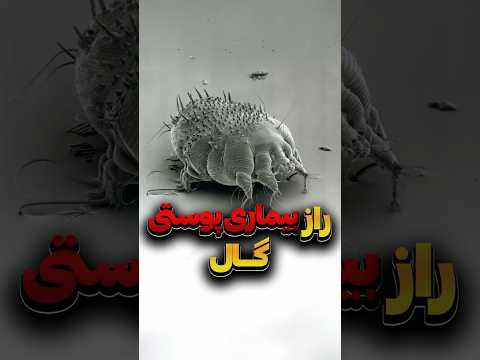 چرا گال یکی از خارش آورترین بیماری هاست دانستنی