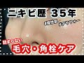 【毛穴ケア】やって良かった角栓ケア、ニキビ予防。脂性肌、アラフォーのスキンケア、ベースメイク、生活習慣