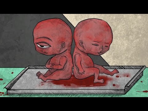 ОДНОГЛАЗЫЙ МАЛЬЧИК _ Life Gallery