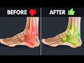 How To Un-F*ck Your Achilles - The Best Fix For Tendinopathy &amp; Chronic Pain