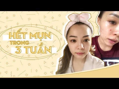 Skincare Buổi Tối Cho Da Mụn ♡ Night Skincare Routine For Acne Prone Skin ♡ TrinhPham