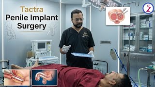 Penile Implant Surgery In India Cost, Recovery & Patient Results Zenith Clinic