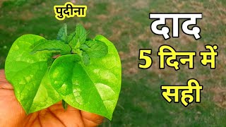 दाद / छाजन एक बार में सही हो जायेगा || Desi dava for daad || Home Garden