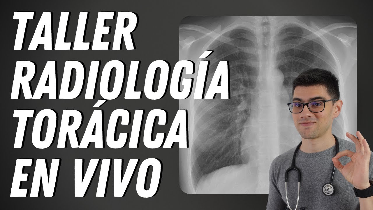 ¿Cómo Leer CUALQUIER Radiografía y TAC de Tórax? TALLER INTERACTIVO