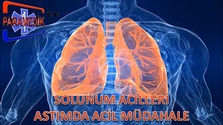 Solunum Acilleri - Astım Krizinde Acil Müdehale Nasıl Olmalıdır ?