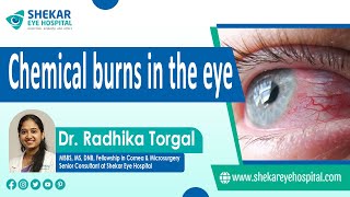 Chemical Splash in Eye | First Aid for Chemical Eye Injury? | Shekar Eye Hospital