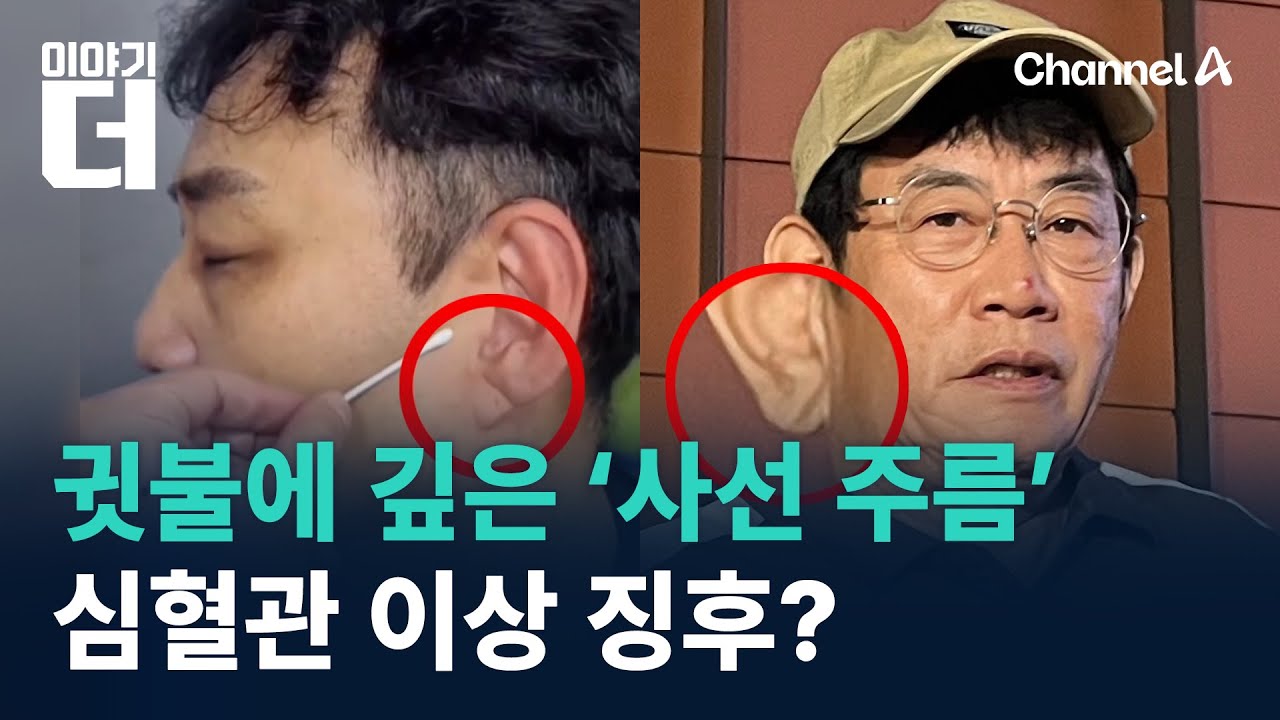 귓불에 깊은 ‘사선 주름’…심혈관 이상 징후? / 채널A / 이야기 더