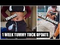 1 WEEK TUMMY TUCK UPDATE | Fibrosis + Drain Removal | Kenyatta Davis