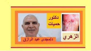 مرض الزهري قابل للشفاء؟| Is syphilis a curable disease