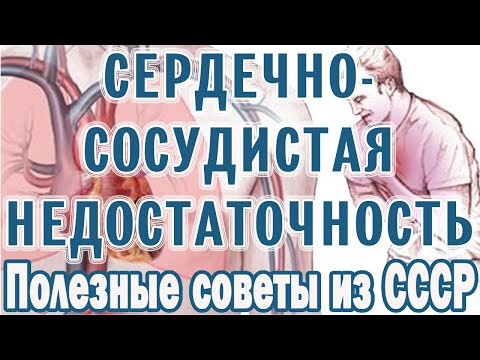 Сердечно-сосудистая недостаточность: как вовремя распознать Сердечная недостаточность Советы из СССР