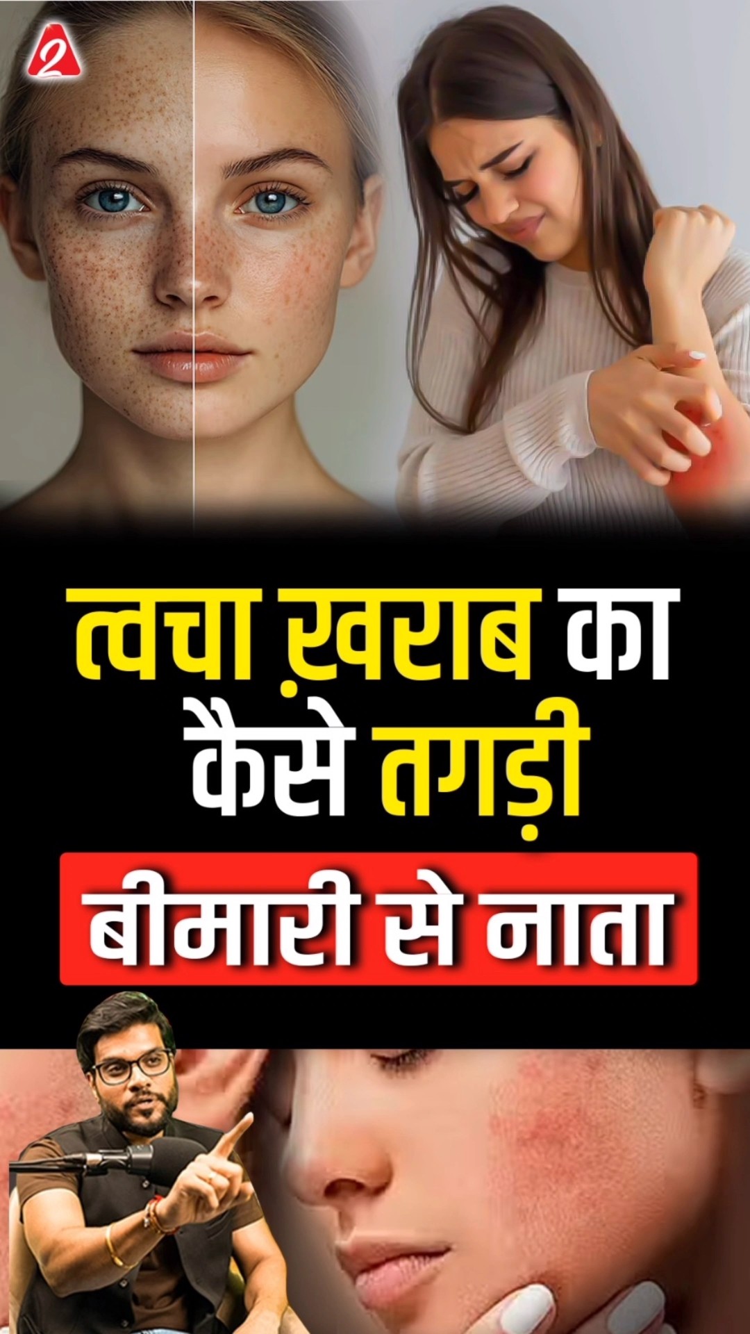 त्वचा ख़राब का कैसे तगड़ी बीमारी से नाता #shorts #youtubeshorts by Dr. #arvindarora #facts